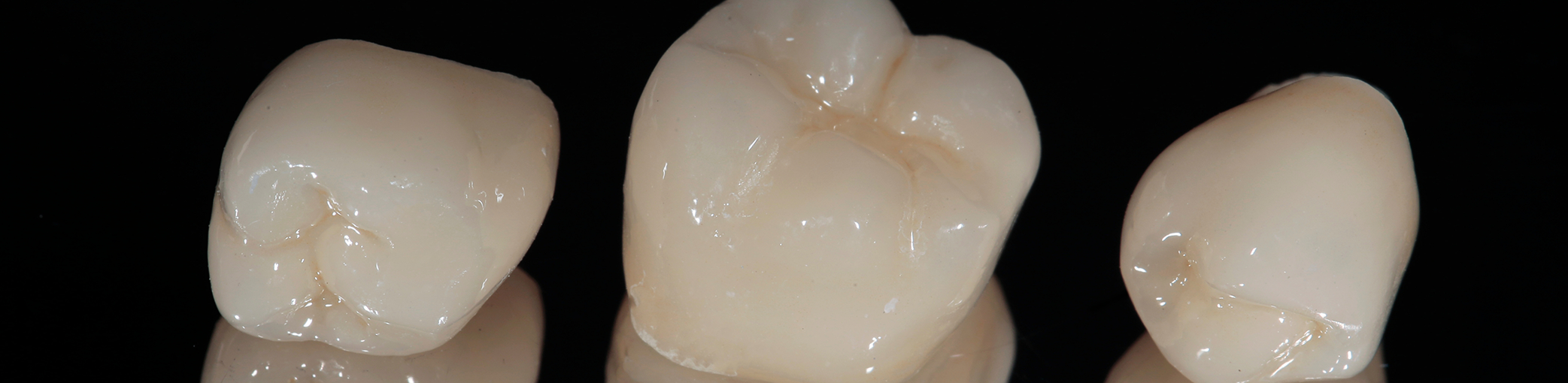 Three porcelain dental crowns in Bullard against a black background